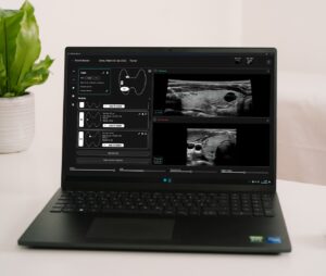 PIUR IMAGING Launches AI-Powered Software Reducing Thyroid Ultrasound Workflow Time by up to 60%